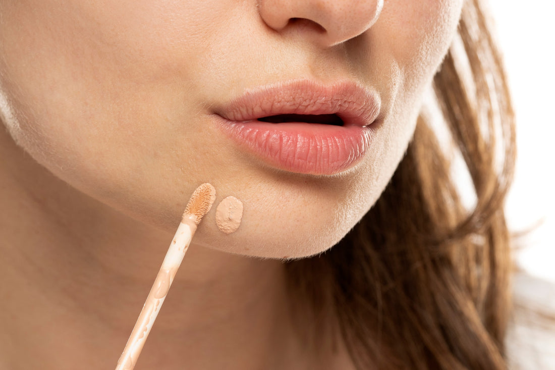 The Right Way to Concealing Pimples